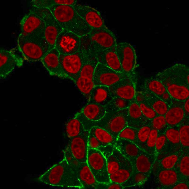 HER-2/c-erbB-2/neu/CD340 Antibody in Immunocytochemistry (ICC/IF)