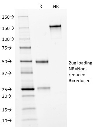 HER-2/c-erbB-2/neu/CD340 Antibody in SDS-PAGE (SDS-PAGE)