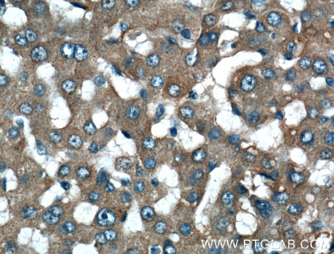 Fibrinogen alpha chain Antibody in Immunohistochemistry (Paraffin) (IHC (P))