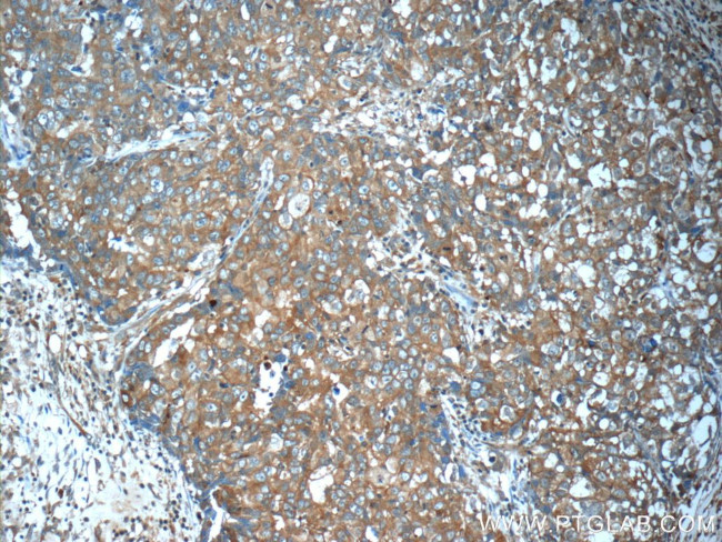 ANO2 Antibody in Immunohistochemistry (Paraffin) (IHC (P))