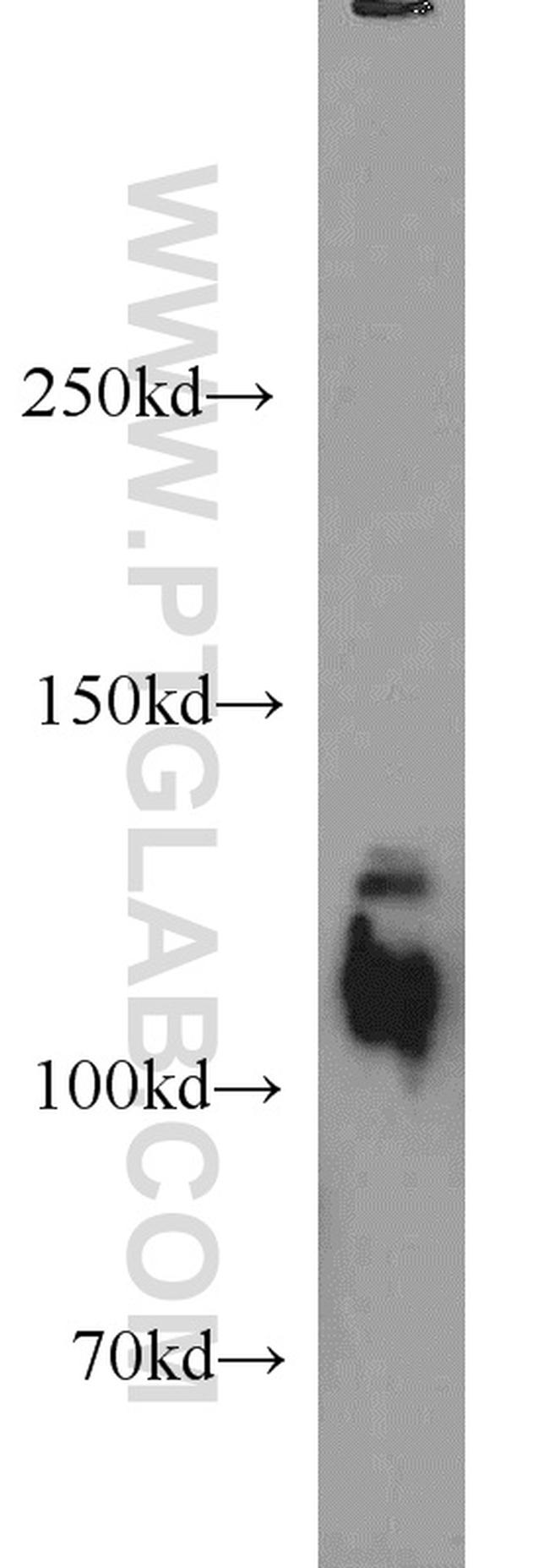 ANO2 Antibody in Western Blot (WB)