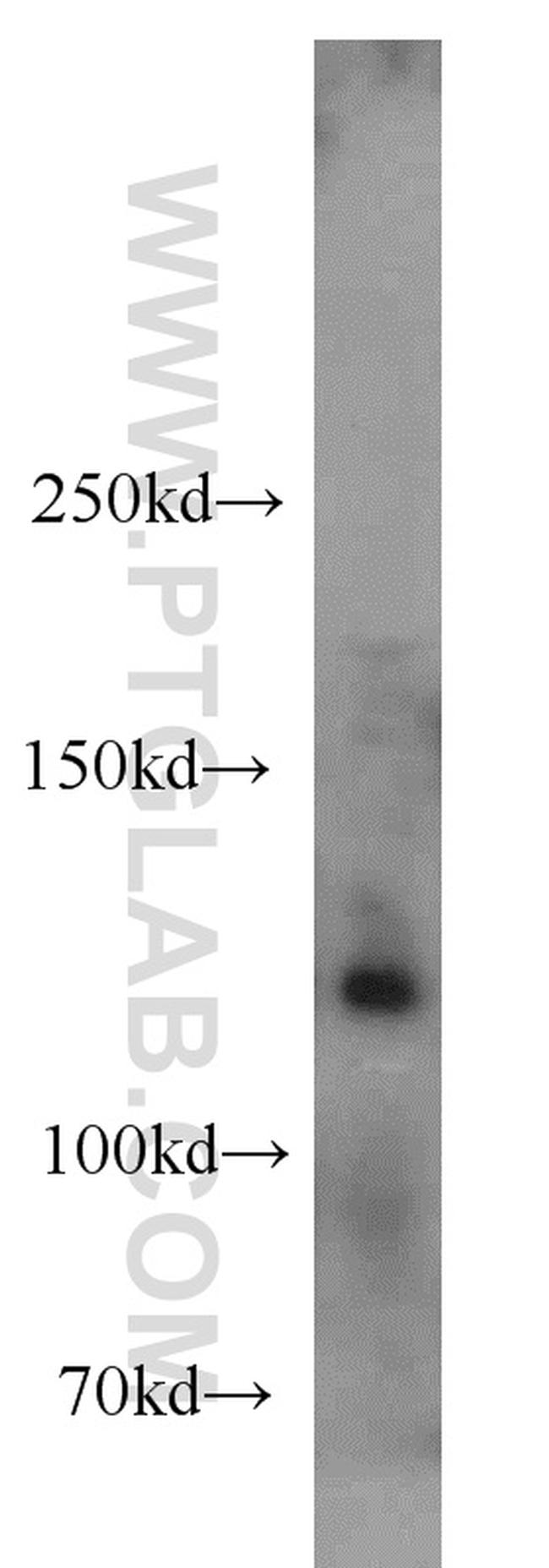 ANO2 Antibody in Western Blot (WB)