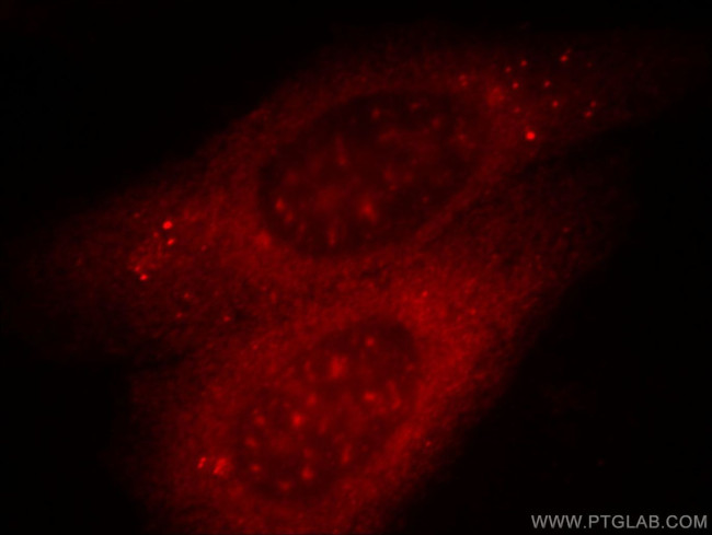 ANO2 Antibody in Immunocytochemistry (ICC/IF)