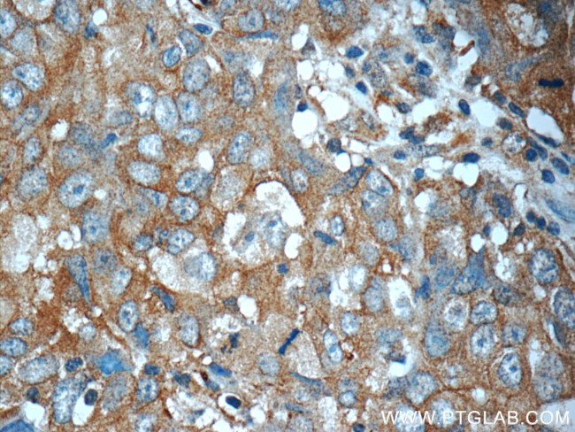 ANO2 Antibody in Immunohistochemistry (Paraffin) (IHC (P))