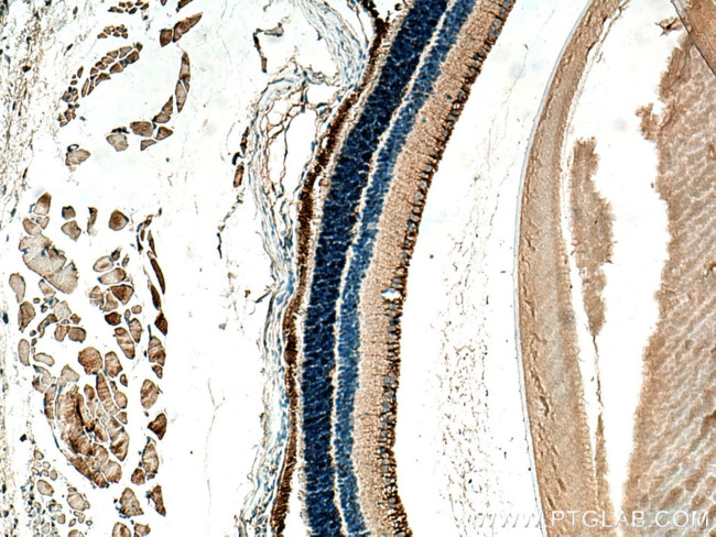 ANO2 Antibody in Immunohistochemistry (Paraffin) (IHC (P))