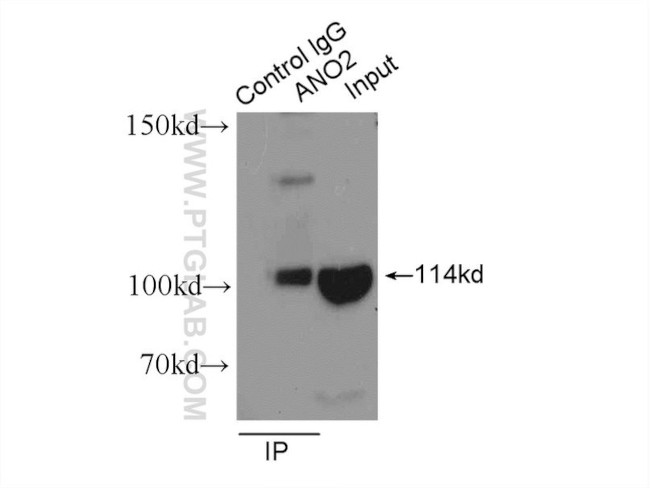 ANO2 Antibody in Immunoprecipitation (IP)