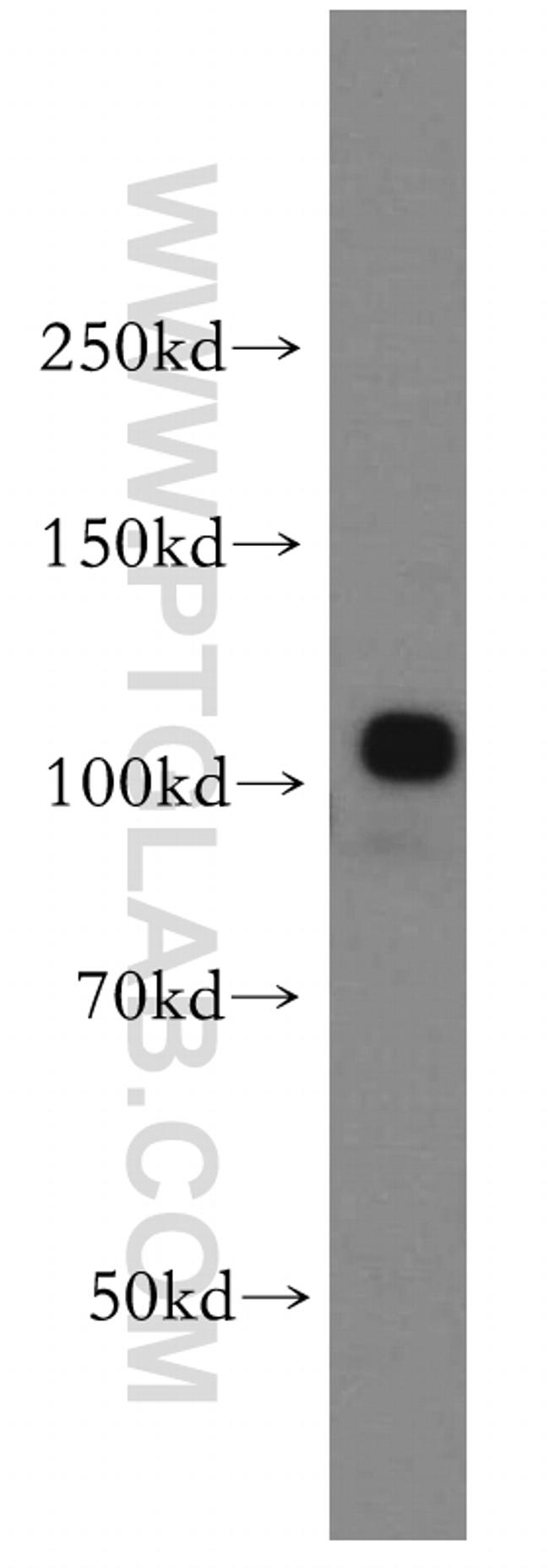 ANO2 Antibody in Western Blot (WB)
