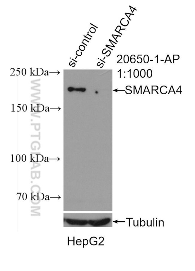 SMARCA4/BRG1 Antibody in Western Blot (WB)