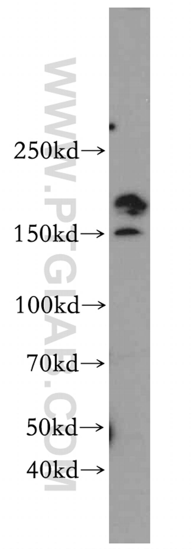 SMARCA4/BRG1 Antibody in Western Blot (WB)