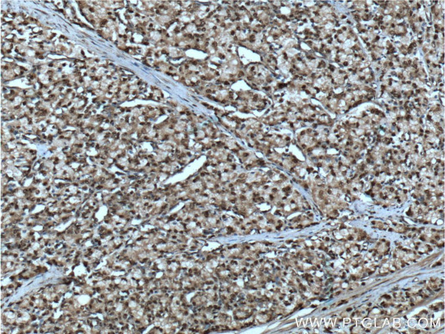 SMARCB1 Antibody in Immunohistochemistry (Paraffin) (IHC (P))