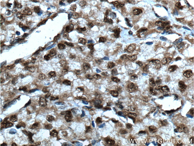 SMARCB1 Antibody in Immunohistochemistry (Paraffin) (IHC (P))