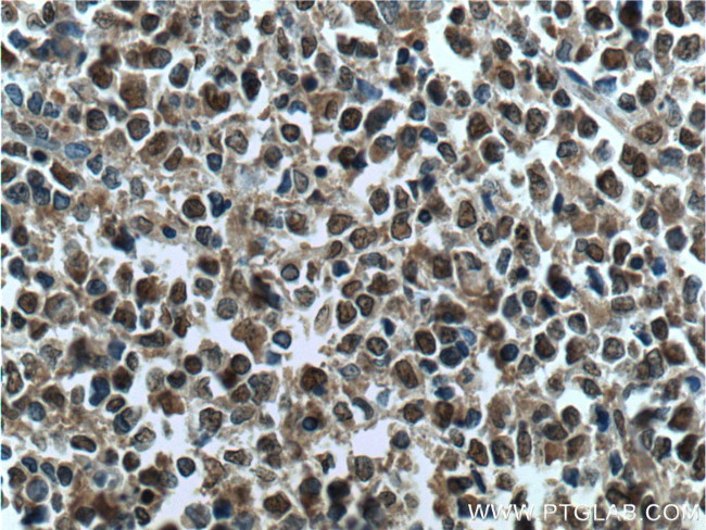SMARCB1 Antibody in Immunohistochemistry (Paraffin) (IHC (P))