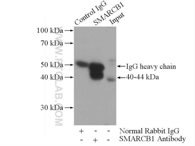 SMARCB1 Antibody in Immunoprecipitation (IP)