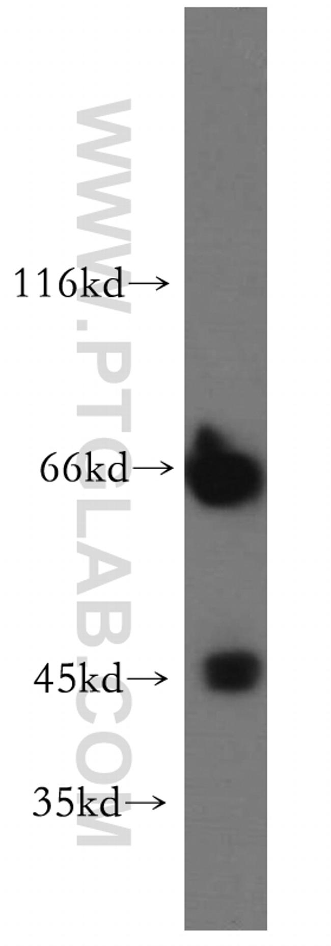 SMARCB1 Antibody in Western Blot (WB)