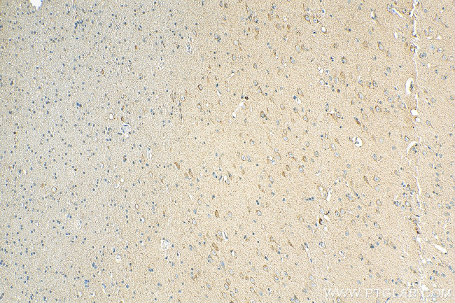 NPTX1 Antibody in Immunohistochemistry (Paraffin) (IHC (P))