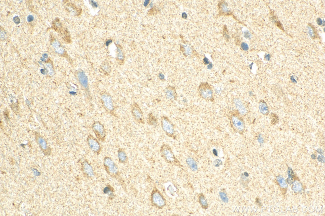 NPTX1 Antibody in Immunohistochemistry (Paraffin) (IHC (P))