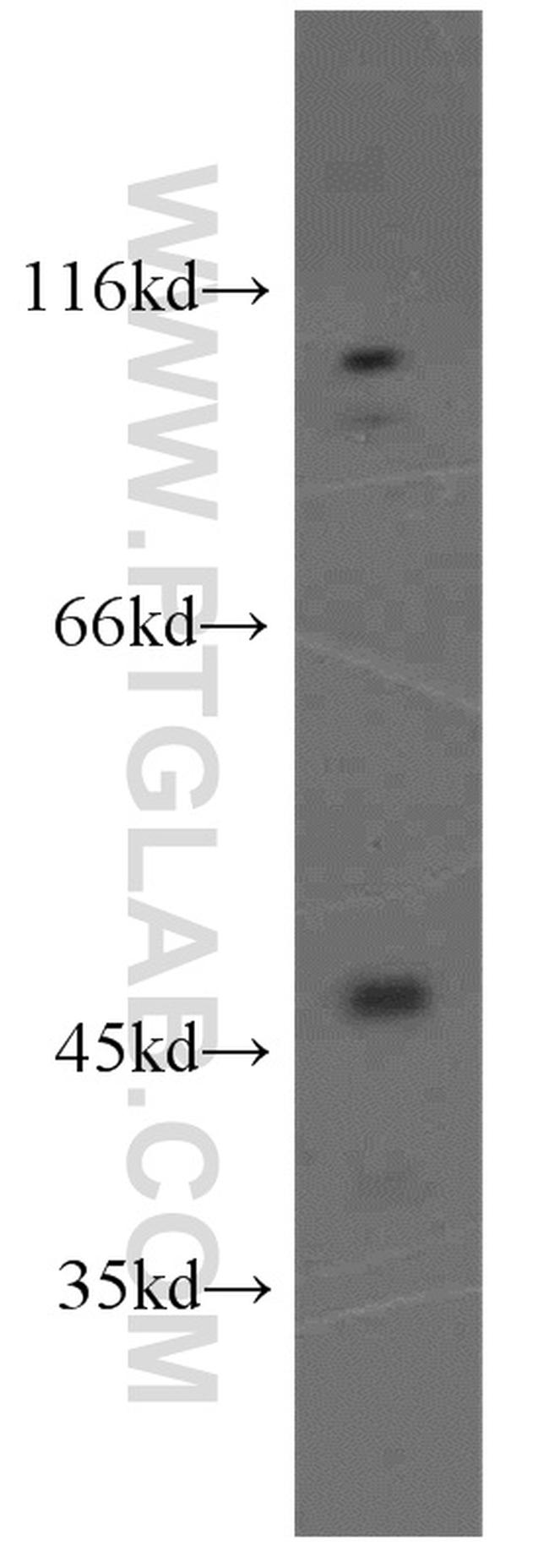 NPTX1 Antibody in Western Blot (WB)