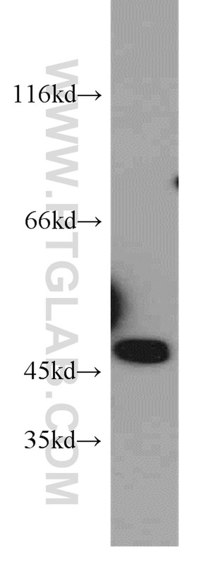 NPTX1 Antibody in Western Blot (WB)