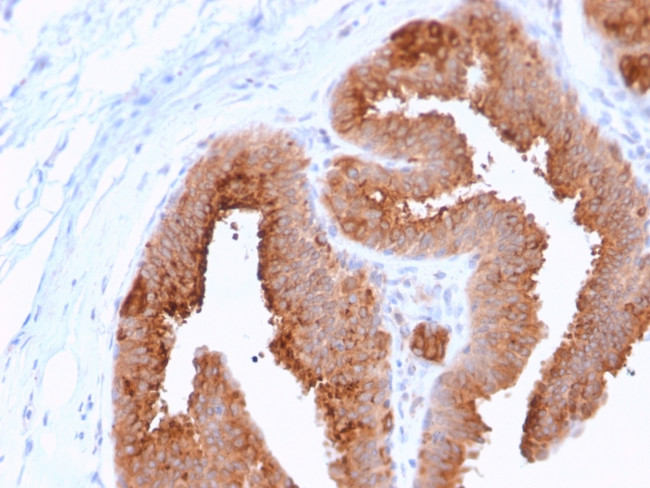 HER-4/ERBB4 Antibody in Immunohistochemistry (Paraffin) (IHC (P))