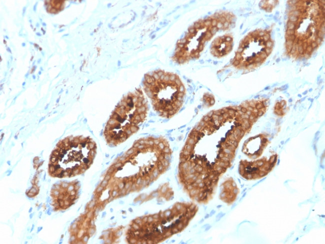 HER-4/ERBB4 Antibody in Immunohistochemistry (Paraffin) (IHC (P))