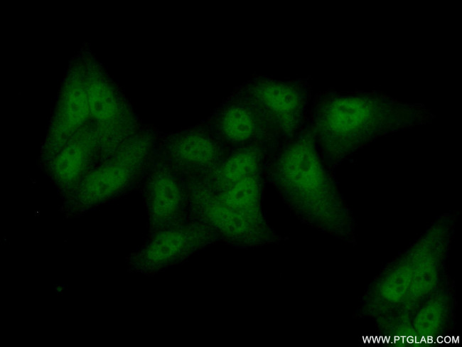 UBF1 Antibody in Immunocytochemistry (ICC/IF)