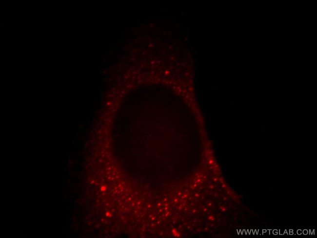 MARCKS Antibody in Immunocytochemistry (ICC/IF)