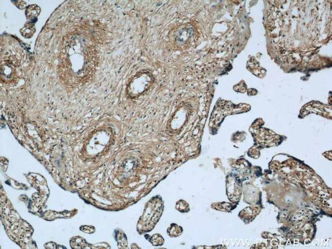 MARCKS Antibody in Immunohistochemistry (Paraffin) (IHC (P))