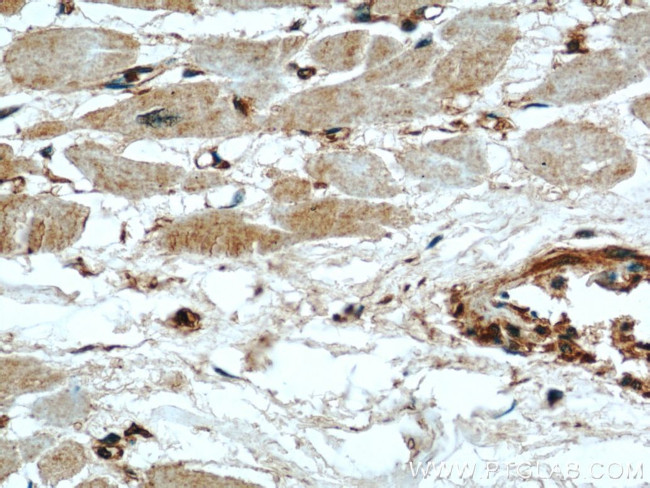 MARCKS Antibody in Immunohistochemistry (Paraffin) (IHC (P))