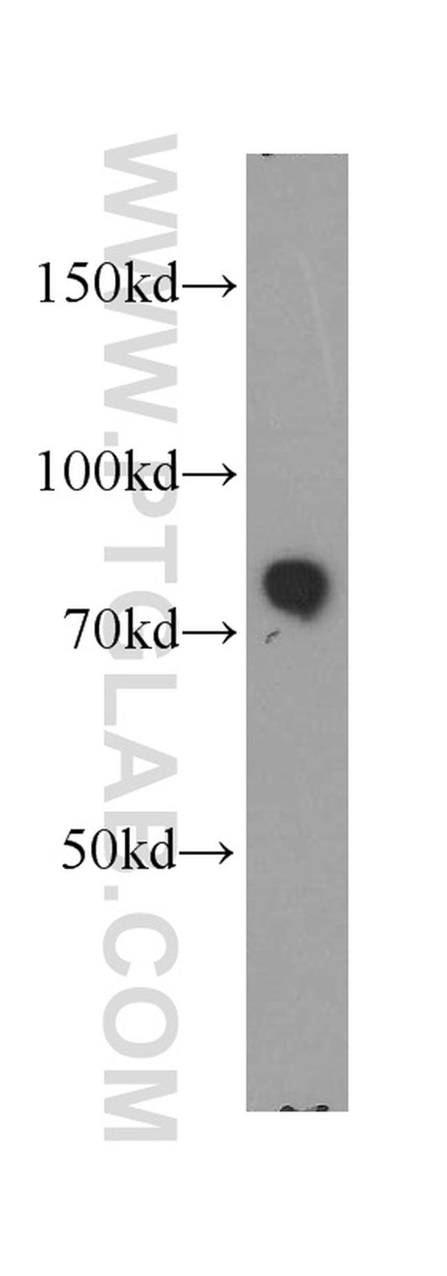 MARCKS Antibody in Western Blot (WB)