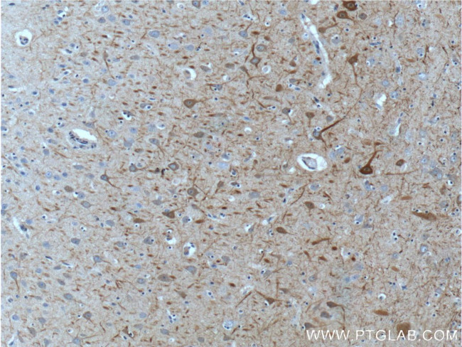 NF-M Antibody in Immunohistochemistry (Paraffin) (IHC (P))