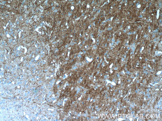 NF-M Antibody in Immunohistochemistry (Paraffin) (IHC (P))