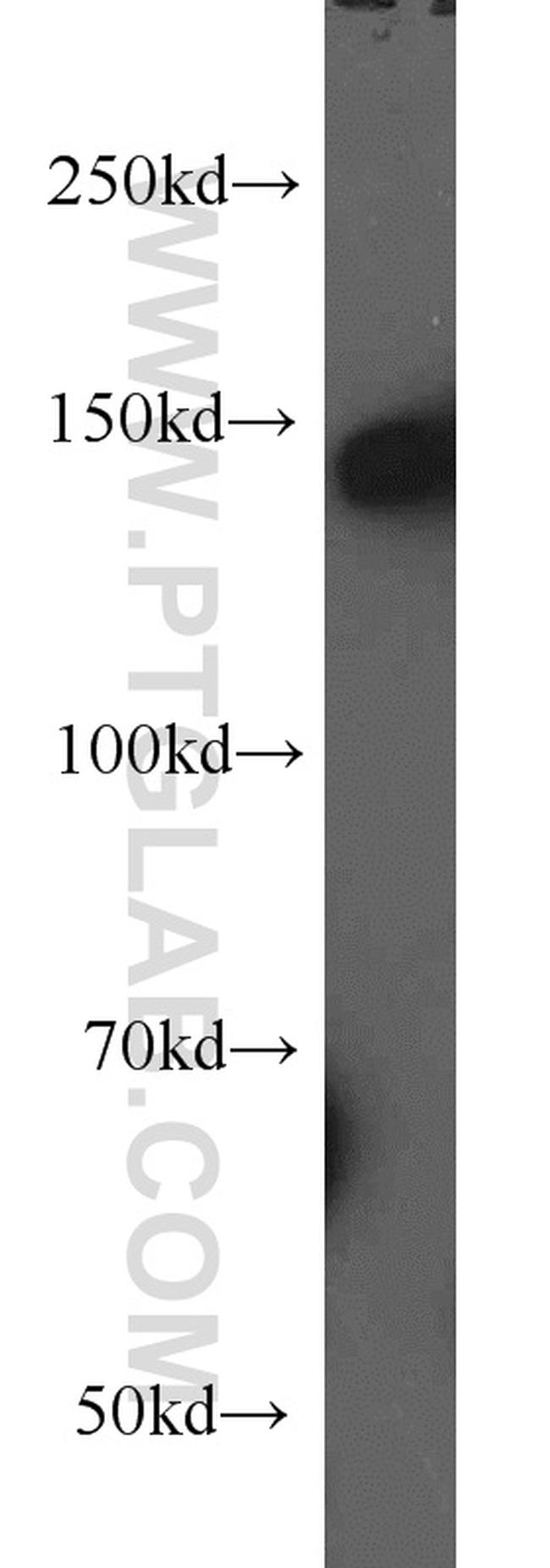 NF-M Antibody in Western Blot (WB)