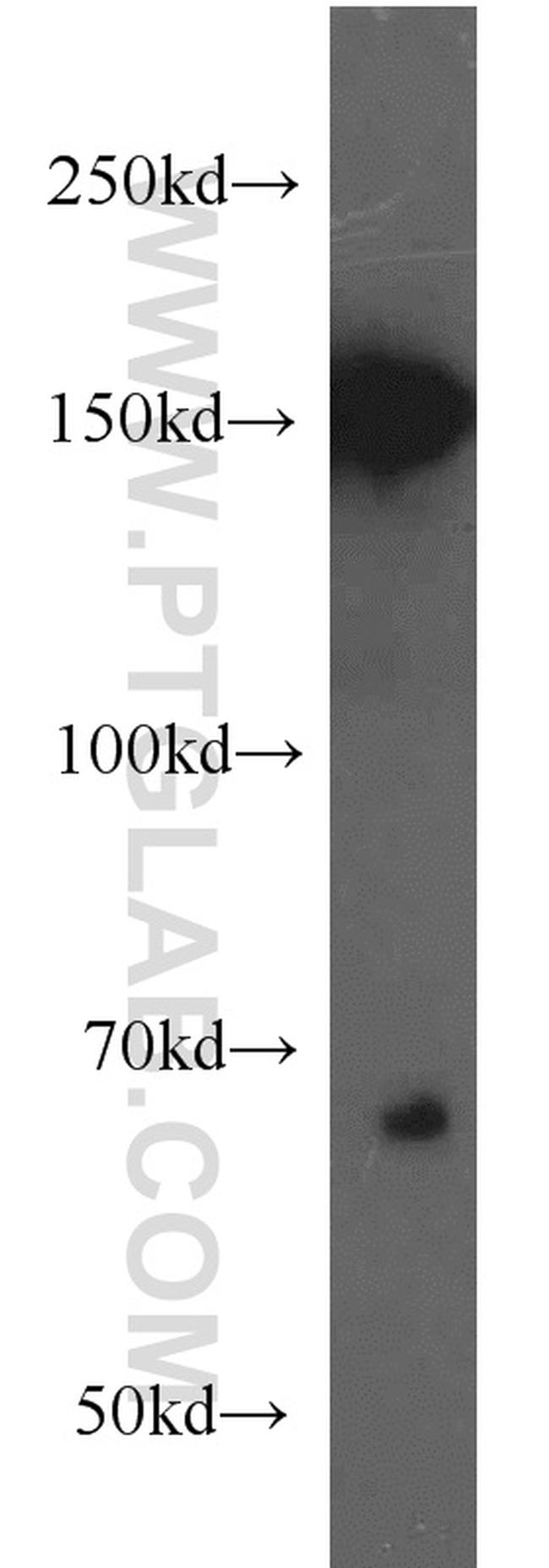 NF-M Antibody in Western Blot (WB)