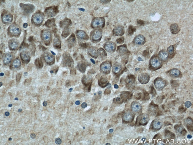 PSD95/DLG4 Antibody in Immunohistochemistry (Paraffin) (IHC (P))