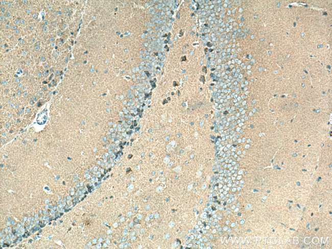 PSD95/DLG4 Antibody in Immunohistochemistry (Paraffin) (IHC (P))