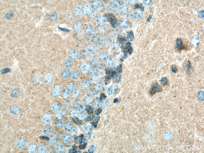 PSD95/DLG4 Antibody in Immunohistochemistry (Paraffin) (IHC (P))