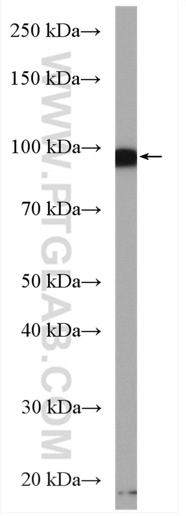 PSD95/DLG4 Antibody in Western Blot (WB)