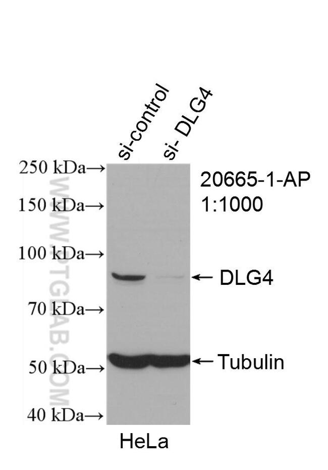 PSD95/DLG4 Antibody in Western Blot (WB)