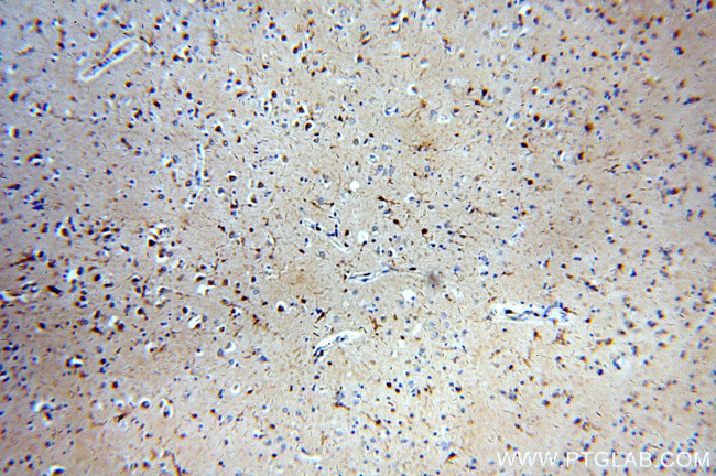 CaMKII delta Antibody in Immunohistochemistry (Paraffin) (IHC (P))