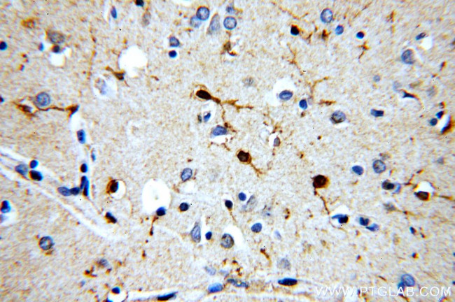 CaMKII delta Antibody in Immunohistochemistry (Paraffin) (IHC (P))