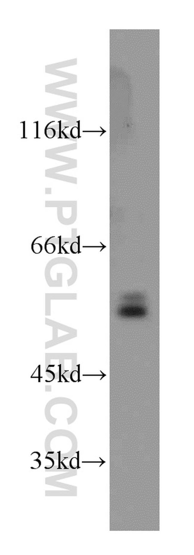 CaMKII delta Antibody in Western Blot (WB)