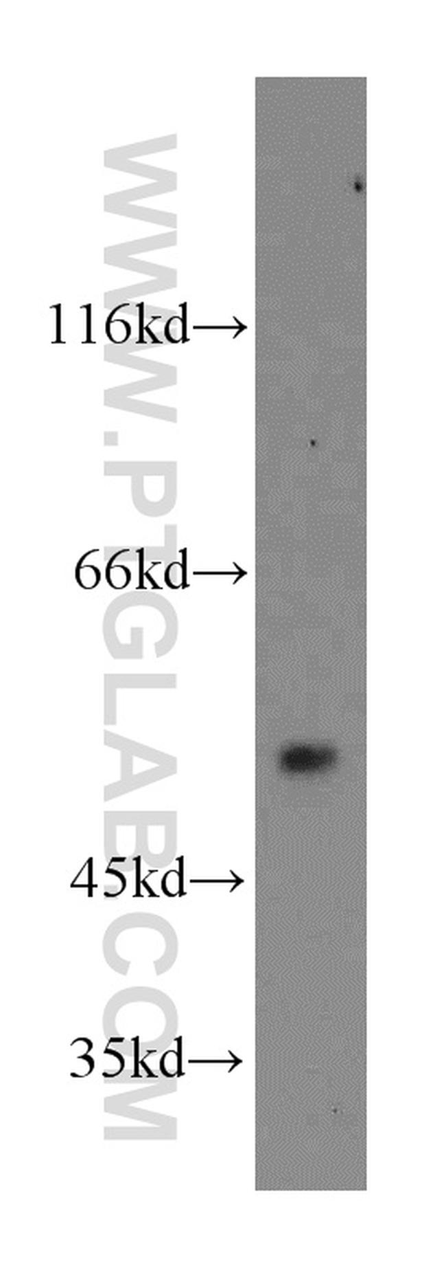 CaMKII delta Antibody in Western Blot (WB)