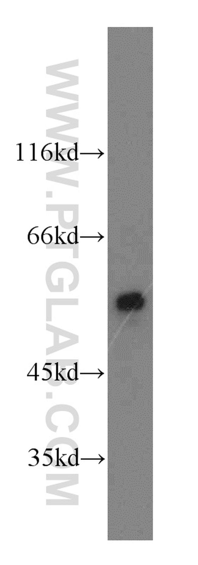 CaMKII delta Antibody in Western Blot (WB)