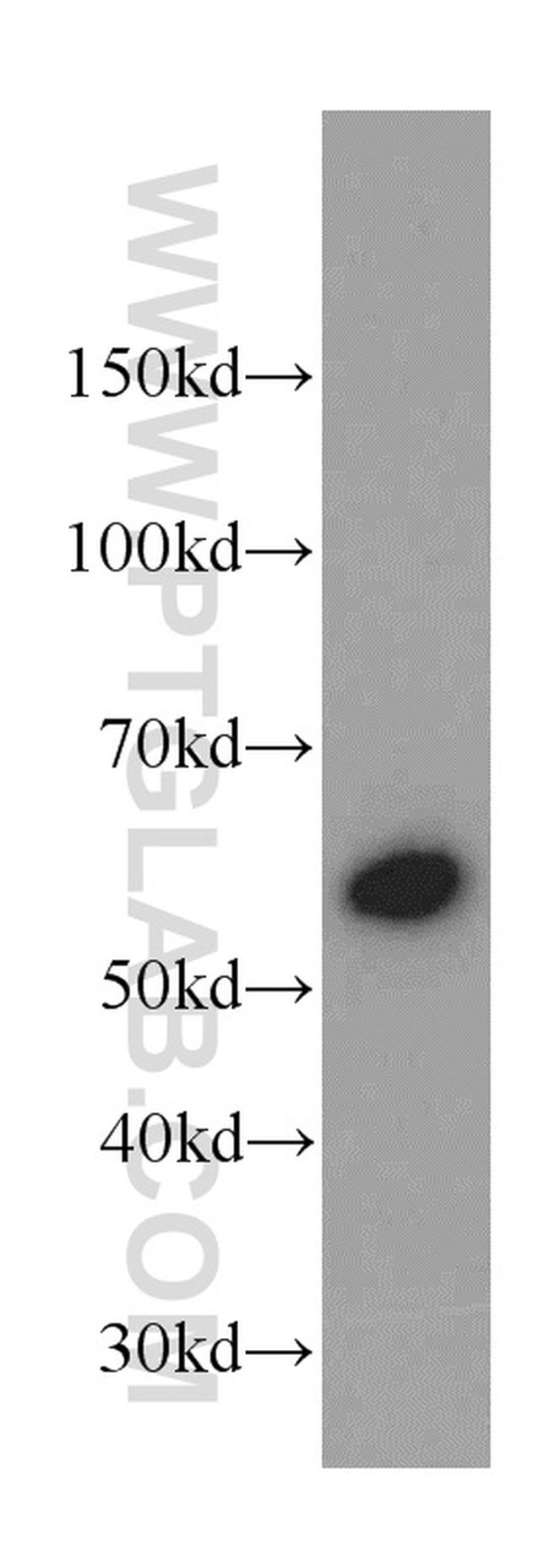 CaMKII delta Antibody in Western Blot (WB)