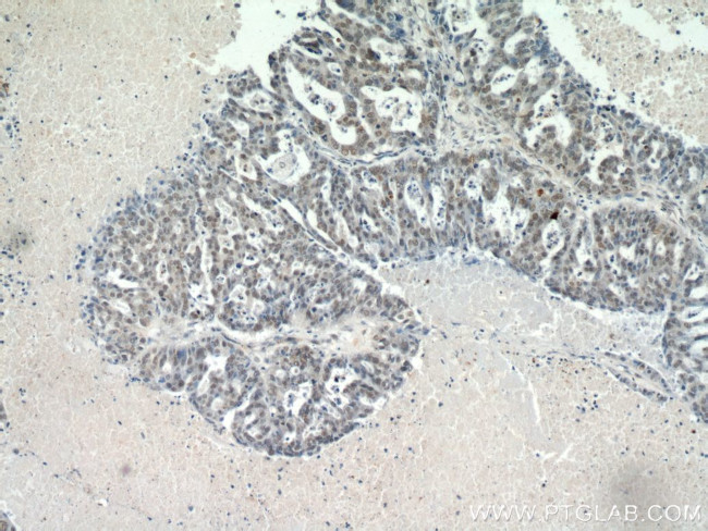 CTR9 Antibody in Immunohistochemistry (Paraffin) (IHC (P))