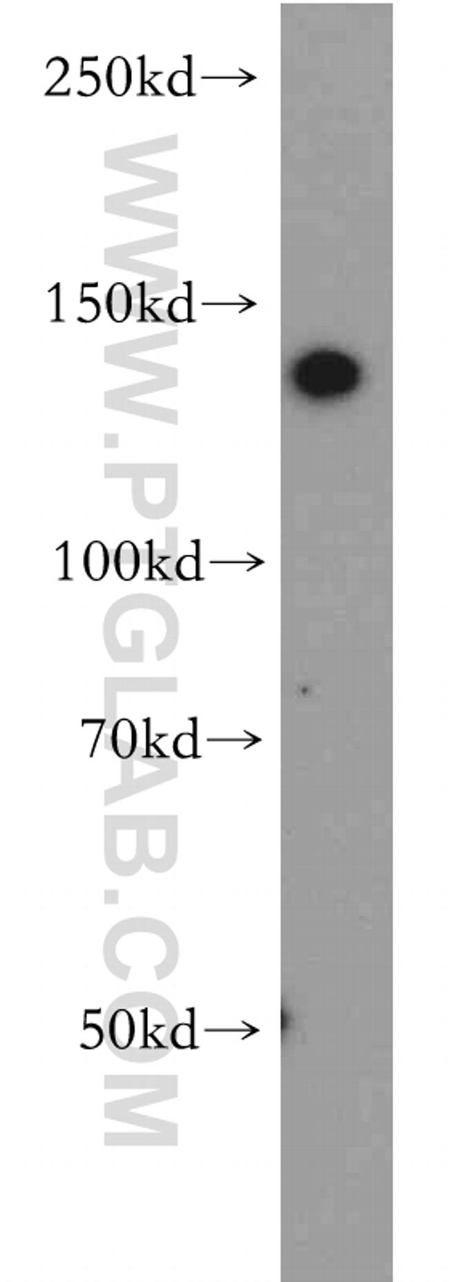 CTR9 Antibody in Western Blot (WB)