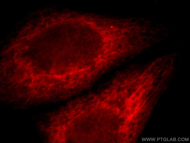 IL17RB Antibody in Immunocytochemistry (ICC/IF)