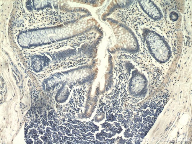 IL17RB Antibody in Immunohistochemistry (Paraffin) (IHC (P))