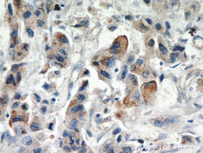 IL17RB Antibody in Immunohistochemistry (Paraffin) (IHC (P))