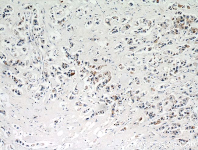 IL17RB Antibody in Immunohistochemistry (Paraffin) (IHC (P))